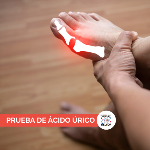 Prueba de Ãcido Ãrico en Chorrera | Examen de Sangre en B/.8.00