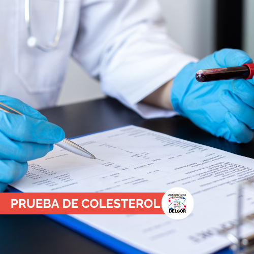 Prueba de Colesterol en Chorrera | Perfil LipÃ­dico en B/.8.00