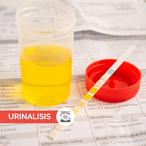 Urinalisis en Chorrera | Examen General de Orina en B/.5.50