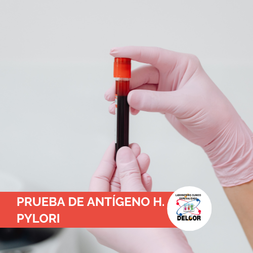 Prueba de AntÃ­geno H. Pylori en Chorrera | Salud Digestiva en B/.26.00