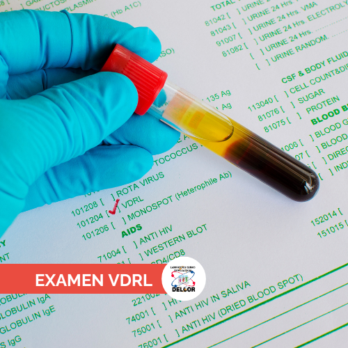 Examen VDRL Chorrera Laboratorio ClÃ­nico Salud Sexual