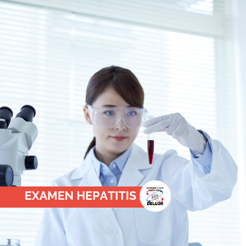 Examen Hepatitis Chorrera Laboratorio para DiagnÃ³stico Preciso