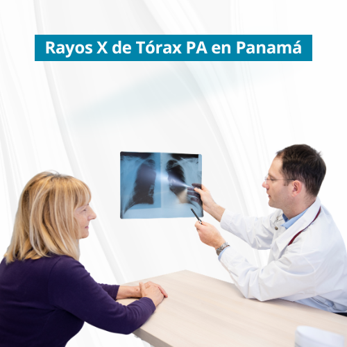 Rayos X de TÃ³rax PA en PanamÃ¡ | Precio $40.00