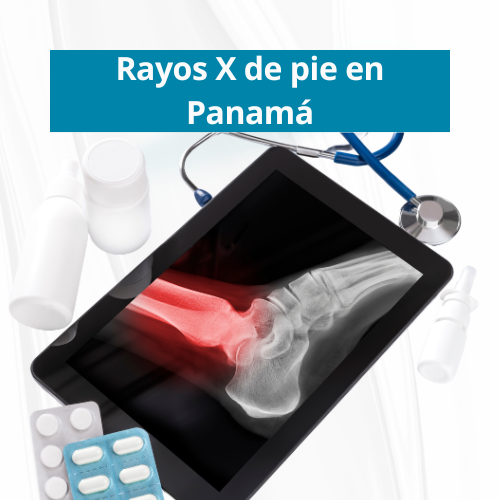 Rayos X de pie en PanamÃ¡ | Precio $40.00