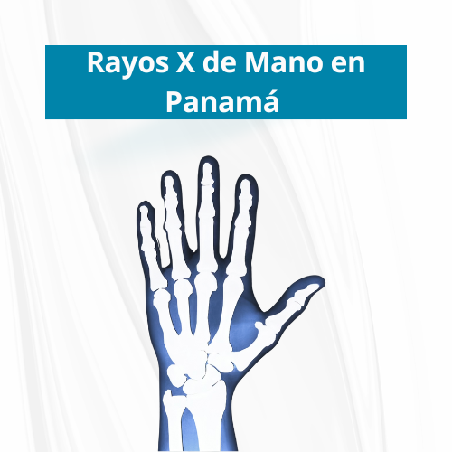 Rayos X de Mano en PanamÃ¡ | Precio $40.00