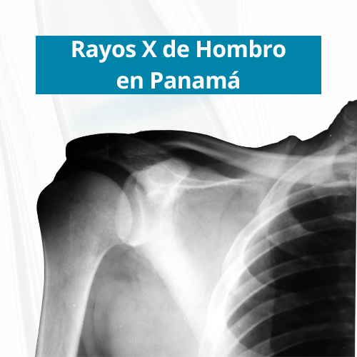  Rayos X de Hombro en PanamÃ¡ | $40.00