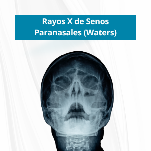 Rayos X de Senos Paranasales (Waters) | Precio $55.00