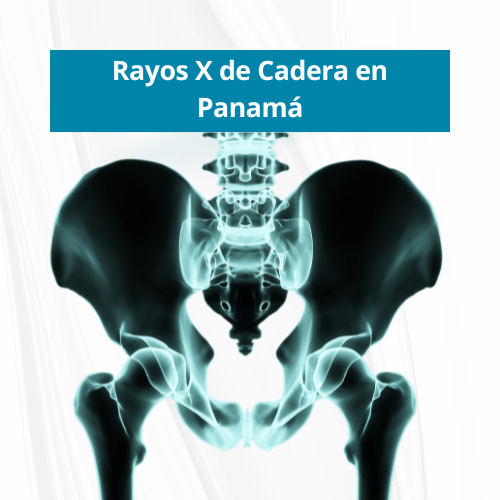 Rayos X de Cadera en PanamÃ¡ | Precio $40.00 VÃ­a EspaÃ±a