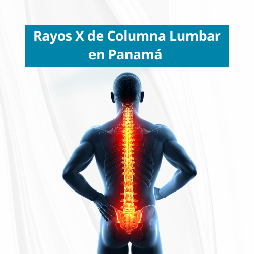 Rayos X de Columna Lumbar en PanamÃ¡ | Precio $55.00