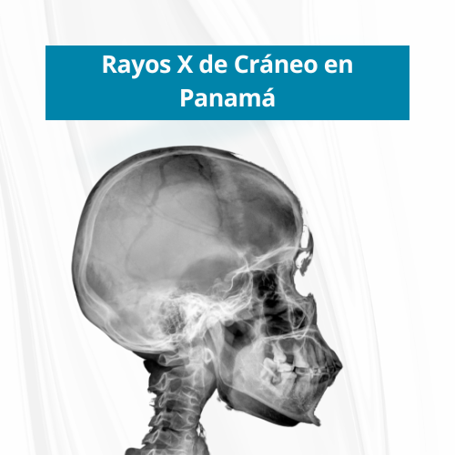 Rayos X de CrÃ¡neo en PanamÃ¡ | $50.00 Sin Cita