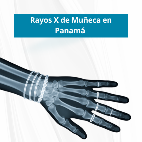 Rayos X de MuÃ±eca en PanamÃ¡ | Precio $40.00
