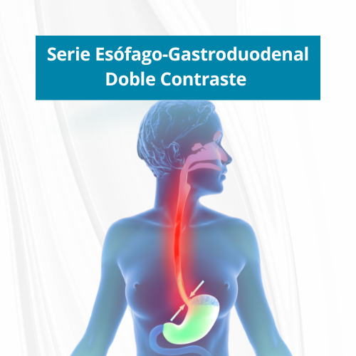 Serie EsÃ³fago-Gastroduodenal Doble Contraste | $120.00