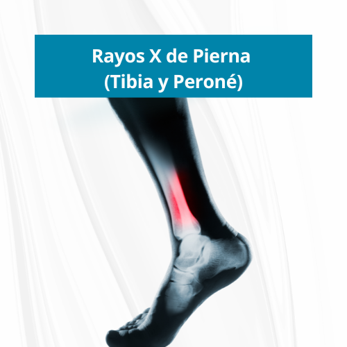 Rayos X de Pierna (Tibia y PeronÃ©) | $40.00 en PanamÃ¡