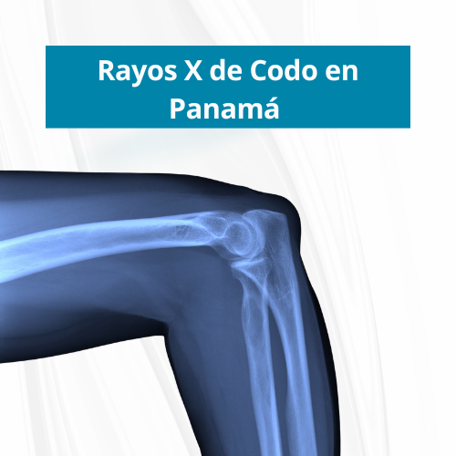 Rayos X de Codo en PanamÃ¡ | Precio $40.00