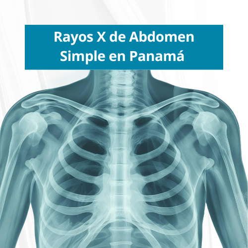 Rayos X de Abdomen Simple en PanamÃ¡ | $40.00