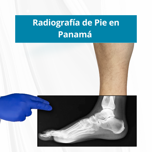 Radiografía de Pie en Panamá | Precio $40.00