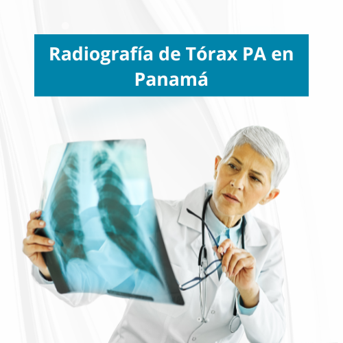 Radiografía de Tórax PA en Panamá | Precio $40.00