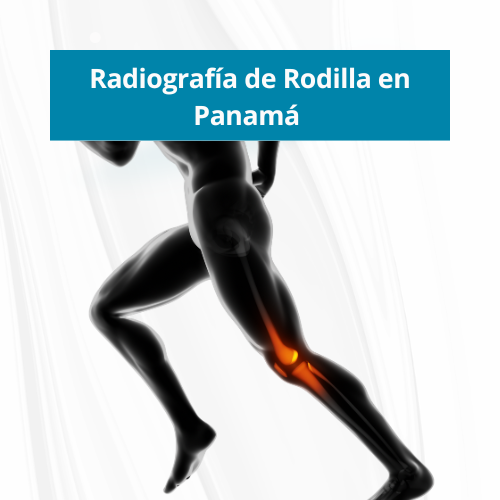  Radiografía de Rodilla en Panamá | Precio $40.00